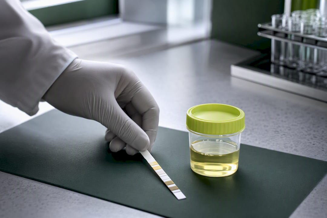 Test urinaire CBD pour contrôles : seuils, preuves et choix sûrs - 420 Green road